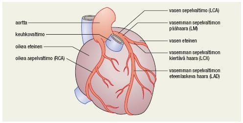 10 sydänlihas vaurioitunut, rintakivun syy ei aina ole sydämessä, sekä vastuun rajaus. (Nikus, Laukkala, Aho & Tala 2009.) 3.