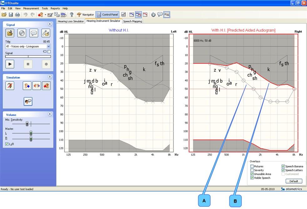 11.3 Ennustettu audiogrammi kuulokojeella -näkymä A. Asiakkaan HTL B.