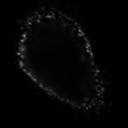 Dekonvoluutio BioImageXD:ssä Käytetään iteratiivista