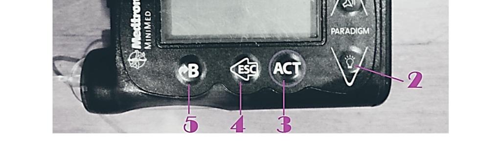 Nuolinäppäin alaspäin 3. Toimintonäppäin ACT 4.