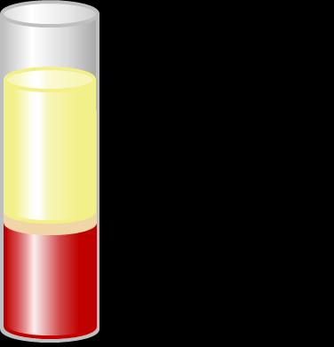 35 7.2.3 Valkosolujen erottaminen kokoverestä ja solujen laskeminen Bürkerin laskukammiolla Valkosolut erotettiin dekstraani-sedimentaatiolla tuoreesta 9 ml:n kokoverinäytteestä.