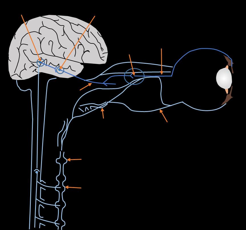 Sympaattisen hermoston hermorungot ja -solmut sijaitsevat molemmin puolin selkärangan vieressä ja ne muodostavat erillisen hermorungon kummallekin puolelle selkärankaa.