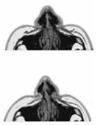 Pelko Inho Kateus=kipu(affekti) Takahashi et al. Science 2009.323.