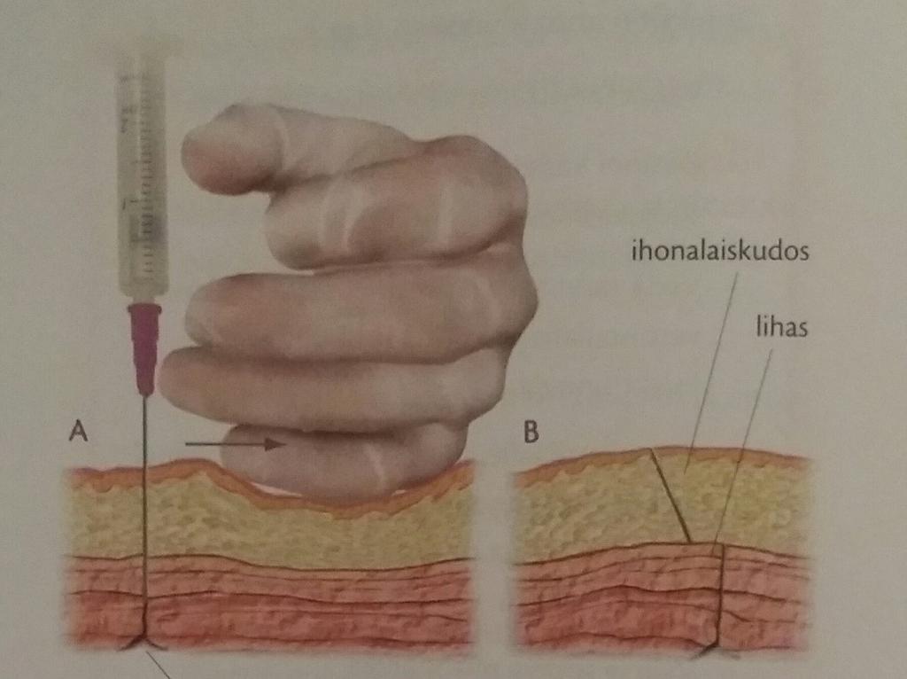 ole suonessa lääkeaine injisoidaan hitaasti lihakseen. Injektionannon jälkeen neula vedetään ulos lihaksesta ja iho vapautetaan vedosta nopeasti. (Brown, Gillespie & Chard 2015, 1132 1139.) 15 Kuva 5.