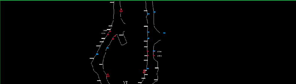 18 Kuvio 9. Kaivoksen 448-tasolta kartoitettu tieto Surpacilla. Tunnelissa tehtyä kattokartoitusta hyödynnetään tehdessä tunnelista DTM (Digital Terrain Model) -tiedostoa.