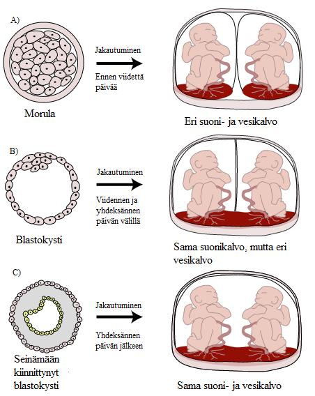 Kuva 2. Monotsygoottisten kaksosten muodostuminen ja munasolun jakautumisen ajankohdan vaikutus hedelmöityksen jälkeen.