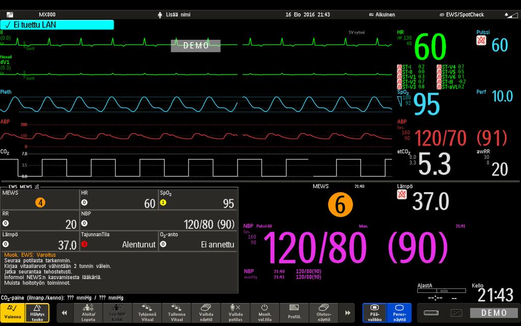 Kuva 9. Näkymä Philips potilasvalvontamonitorista ja NEWS-laskurista lopullisessa käyttönäkymässä. (Tuppurainen, Philips 2016).