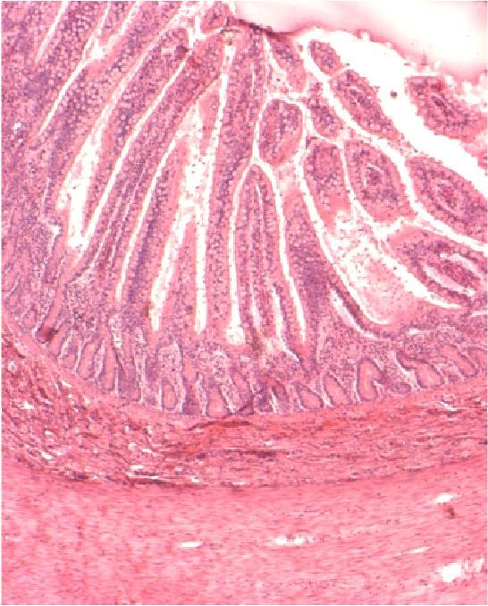 suolen lumenissa. Yhtä kaikki epiteeli ja lamina propria ovat niissä hyvin tarkasteltavissa.