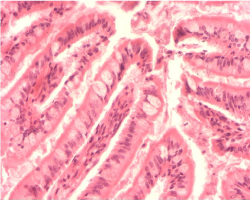 tyypillisesti runsaammin ileumissa. Mikroskopia: Orientoidu näytteeseen pientä suurennosta käyttäen.