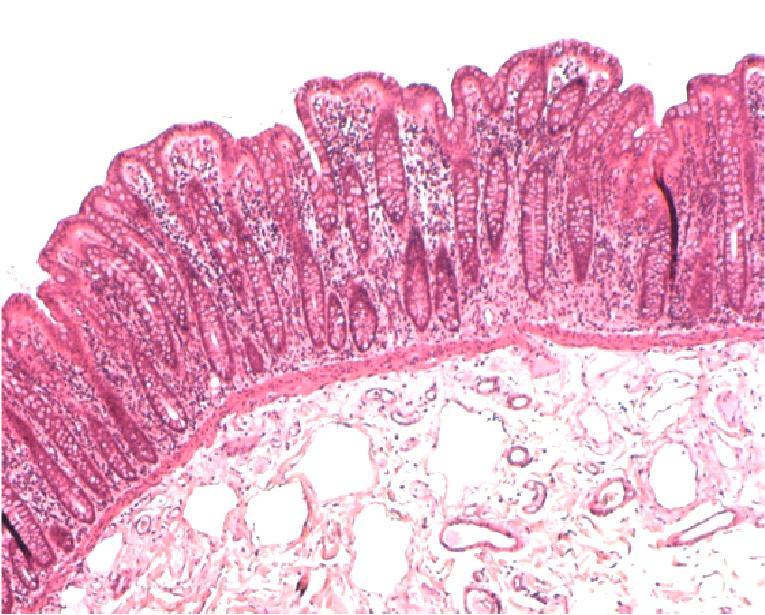 Tarkemmassa tarkastelussa löydät kryptojen pohjalta Panethin solut (RP kuva 17.