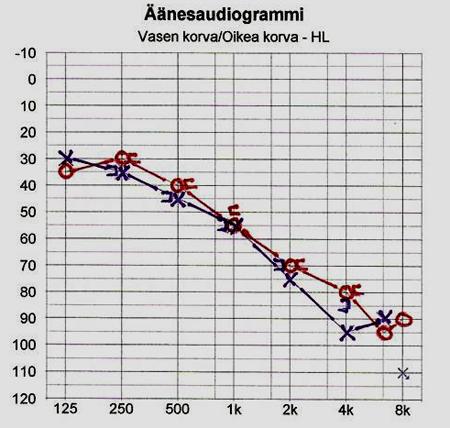 12 kuulo-ongelmastaan ja peilata sitä saatuihin tuloksiin. Usein ikäkuuloa tutkittaessa tutkittavan oma näkemys kuulon heikkenemisestä eroaa verrattuna audiogrammitutkimukseen. (Hannula ym. 2006.