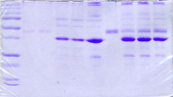 58 37 kd) proteiini näyttäisi tarttuneen proteiini A palloihin kontrollissa 13.