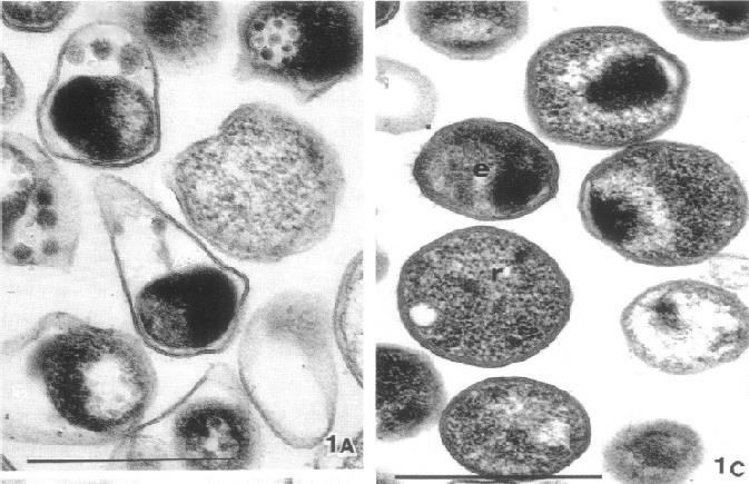 8 Kuva 1. 1A C.pneumoniae:n EB-partikkelit erottuvat selkeästi päärynän mallisina. 1B kuvassa Chlamydia trachomatis:en EB ja RB-partikkelit ovat aivan pyöreitä. Mittasuhde 0,5 µm (mukaillen Chi ym.