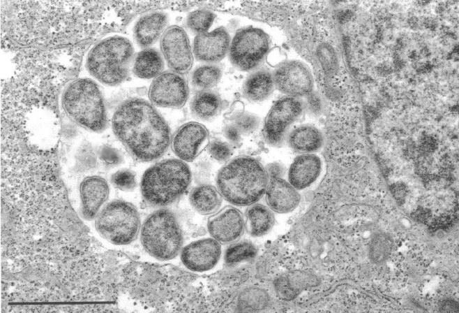 12 metaboliaa omaan elintoimintaansa. RB-partikkelien jakautuessa inkluusio kasvaa samalla kokoa ja täyttyy klamydia-partikkeleista. Kuva 2. RB-partikkelit inkluusion sisällä (Mukaillen Chi ym.