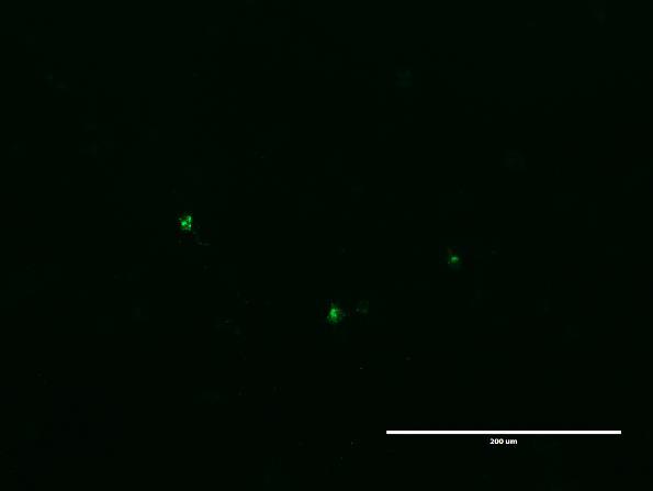 72 A B Kuva 19. Immunofluoresenssivärjäyksellä todennetut C.pneumoniae-bakteerin inkluusiot bakteerien uudelleen muodostumista mittaavassa kokeessa.