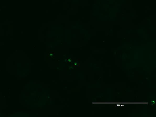 Kuvassa B vihreät pallot ovat klamydia-inkluusiota. Kuvassa A inkluusiot ovat osittain hajonneet. MOI 0,2, mittajana 200 µm 8.3.