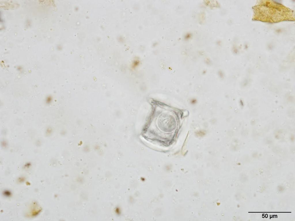 Kuva 8 Moniezia sp. (Kuva: Anu Näreaho) 4.5 Tilastollinen analyysi 4.5.1 Yleistä Tilastollisessa analyysissa voidaan käyttää muun muassa parametrisiä ja ei-parametrisiä analyyseja.