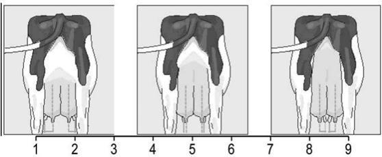 Etuvedinten paksuus (Lineaarinen rakennearvostelu 2015, 12) Etu- ja takavedinten sijaintia arvostellaan lehmän takaa katsomalla vedinten sijoittumista neljänneksessä.