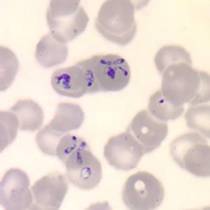 Babesia