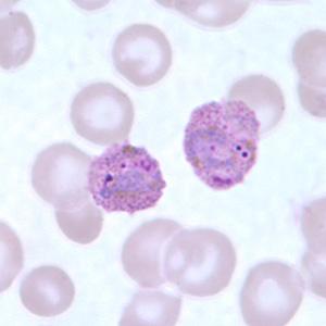 Plasmodium