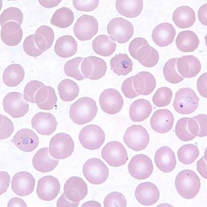 Plasmodium