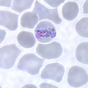 Plasmodium