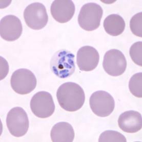 Plasmodium