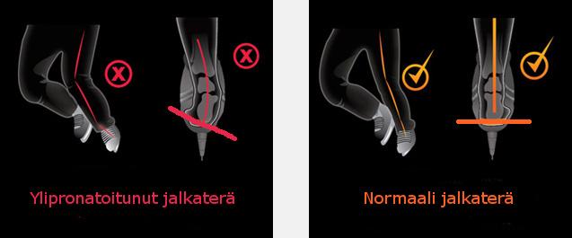 7 Kuvio 3. Ylipronatoitunut jalkaterä (vasemmalla) johtaa suljetun kineettisen ketjun hajoamiseen ja epäedulliseen voiman siirtämiseen.