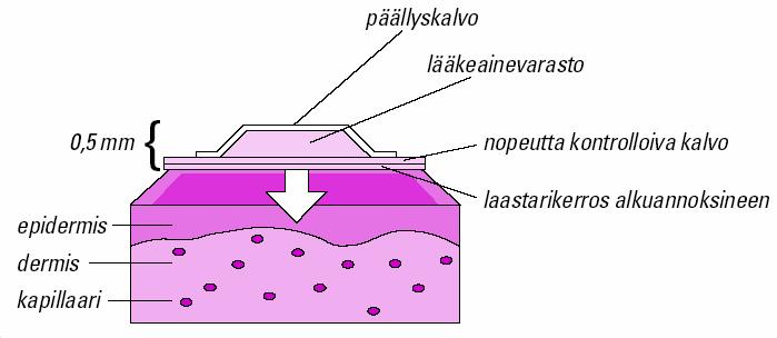 Fentanyyli syöpäkivun