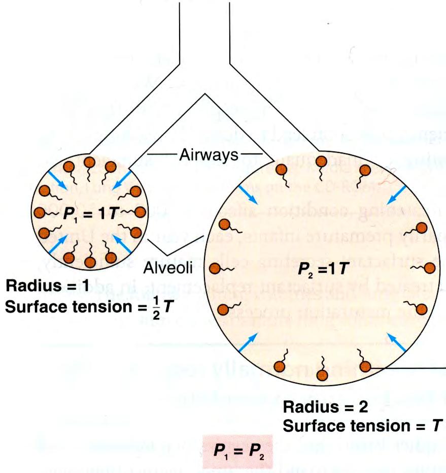 Terveissä keuhkoissa näin ei tapahdu, koska alveolista erittyvä surfaktantti tasaa alveoleja kokoonpainavan voiman