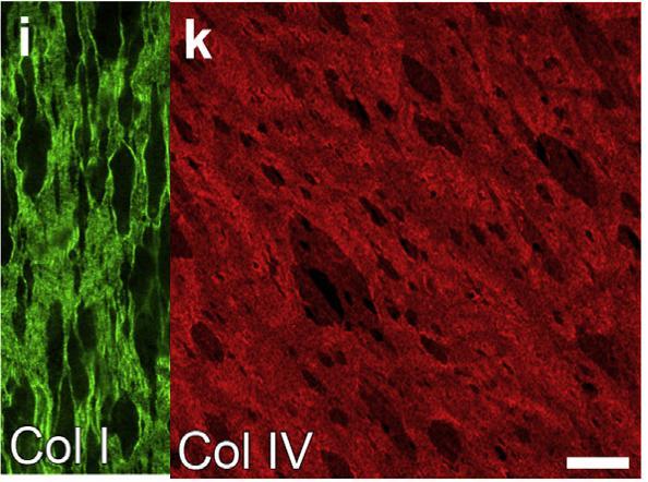 Biomimeettinen kollageeni I+IV Langmuir- Schaefer kalvo