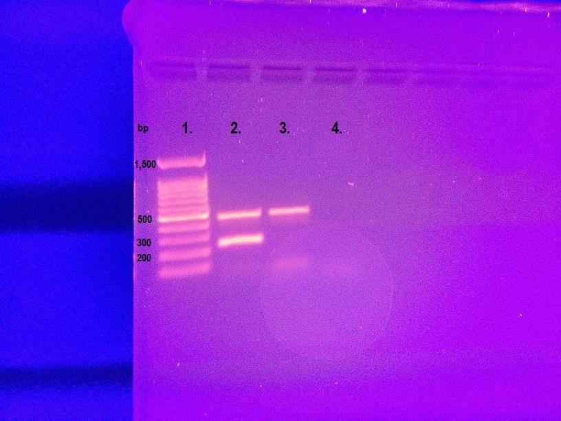 KUVIO 3. Sigma-Aldrich LookOut PCR Detection Kit. 1) RTU DNA Ladder I, 2) positiivinen kontrolli, 3) negatiivinen kontrolli, 4) kuumennusmenetelmällä tehty LNCaP -näyte.