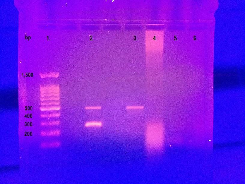 KUVIO 5. Sigma-Aldrich LookOut PCR Detection Kit. 1. RTU DNA ladder I, 2. positiivinen kontrolli, 3. negatiivinen kontrolli, 4. eristetty DNA, 5. pelkkä medium 6. kuumentamalla tehty näyte.