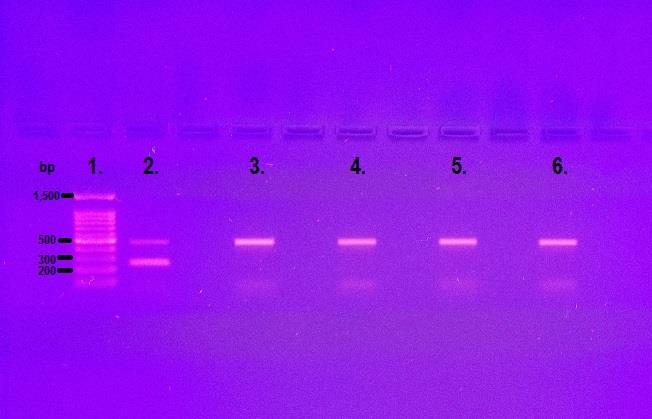 KUVIO 7. Sigma-Aldrich LookOut PCR Detection Kit. 1. RTU DNA Ladder I, 2. positiivinen kontrolli, 3. negatiivinen kontrolli, 4. eristetyn DNA:n 1:100 laimennos, 5. kuumentamalla tehty näyte, 6.