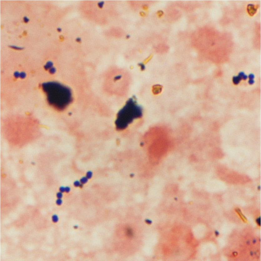 on esitetty näytteen M1064 värjäystulos. Kyseessä on gramnegatiivinen sauva, E. coli.