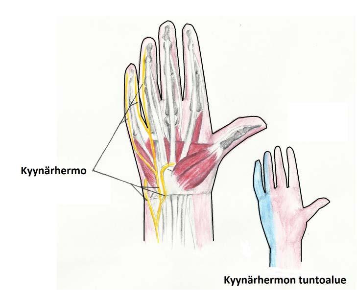 Kuvio 7. Kyynärhermon tuntoalue 4.3.2 Alaraajojen hermot Reisihermo (Nervus femoralis) Reisihermo on lannepunoksen (plexus lumbaalis) keskeinen hermo ja se alkaa L2-L3 hermojuurista.