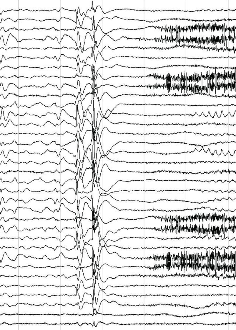 Lasten epilepsiaosasto L11 ja video-eeg HYKS Lastenlinna Käyntiosoite: