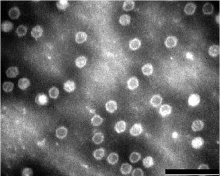 4 Kuva 2. Elektronimikroskooppikuva parvorokkoviruskapsideista. Oikean alanurkan mittakaavajanan pituus 100 nm. (Heegaard & Brown 2002).