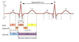 8 sydämen sähköistä toimintaa. Arkikielessä EKG:sta käytetään myös nimitystä sydänfilmi. EKG-käyrästä voidaan nimetä ja tunnistaa erilaisia aaltoja ja komplekseja.