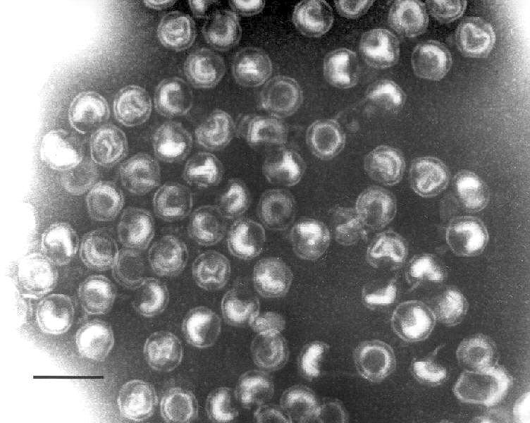 Virophage" = viruksen faagi Jättiviruksilla on omat faaginsa, jotka tekevät ne sairaiksi