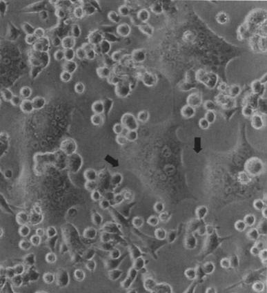 ja antiviraalisen hoidon seuranta > genotyyppaus > molekulaari-epidemiologiset ja evoluutiotutkimukset Antiviraalisia aineita (lääkkeitä) käytetään hoidossa.