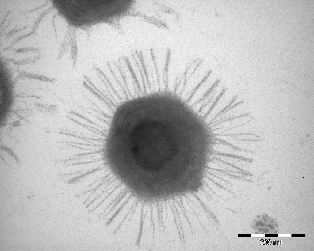 Iso ja pieni virus Mimivirus: 1,2 Mega bp Anellovirus: TTV: 3,8 kbp Bendinelli et al Clin Microbiol Rev 14; 2001 Raoult et al Science 306; 2004 Mimi: 400nm Circo: 20nm VIROLOGIAN HISTORIA 1000-luku