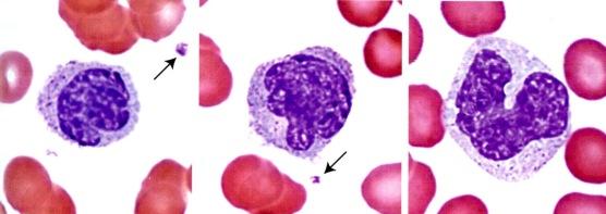 Se hakeutuu kudoksiin, joissa se kypsyy makrofagiksi tai muuksi mononukleaarisen fagosyytti-järjestelmän soluksi. mikronia läpimitaltaan) ja sen tumassa on lovi tai tuma on munuaisen muotoinen.