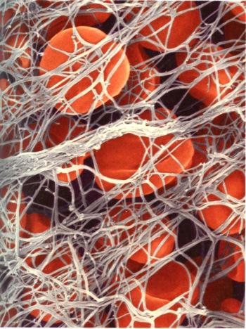 Syntyy fibriini-monomeeri, joka nopeasti polymeroituu fibriinirihmoiksi ja muodostaa verkostoja. Veren solut jäävät verkostoon jumiin ja syntyy verihyytymä. Veren toimintoja ovat mm.