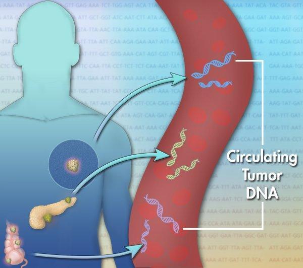 Soluvapaan DNA:n, ctdna tutkiminen Liquid biopsies are non-invasive blood tests that detect circulating tumour cells (CTCs) and fragments of tumour DNA that