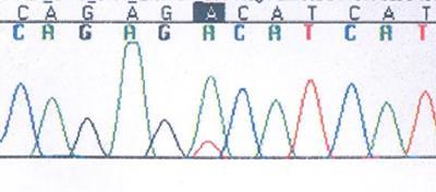 Next generation sequencing, NGS Massive parallel sequencing, MPS sekvensoidaan moninkertaisesti useita geenialueita