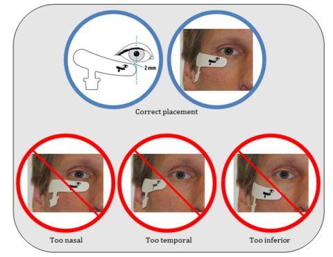 26 Tutkimuksen suorittaminen Welch Allyn RETeval-DR Valmistele potilas. RETeval-DR-anturiliuskat ovat erilaisia oikealle ja vasemmalle silmälle.