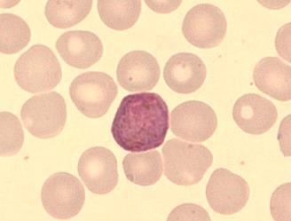 (Microscopic Diagnosis of Malaria. 2009.) Trofotsoiitti P.