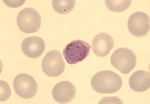 Niitä ympäröi tummanruskea pigmenttimassa. (Microscopic Diagnosis of Malaria. 2009.