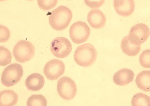 21 3.1.3.4 P. malariae Rengasmuoto eli varhaisvaiheen trofotsoiitti P.